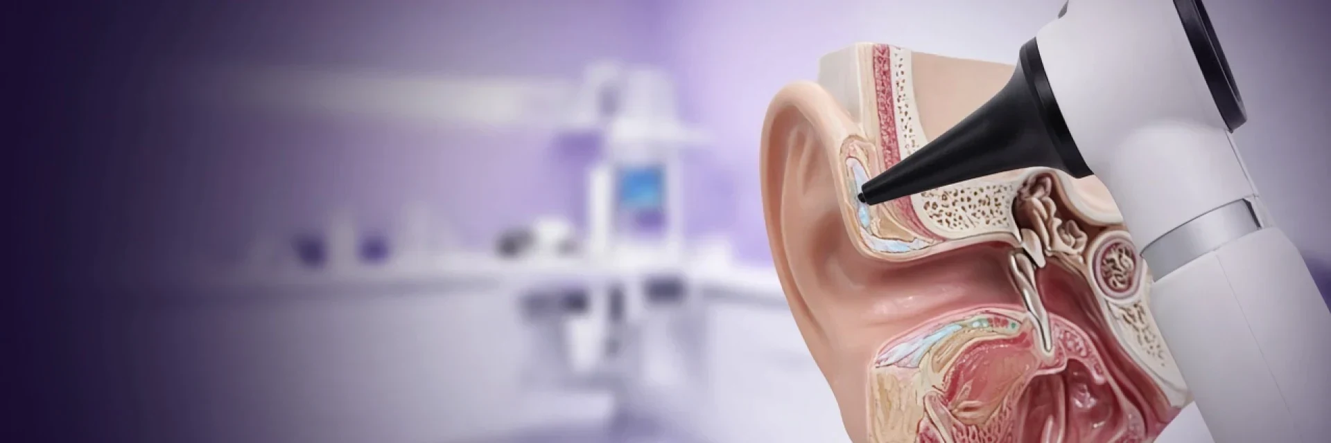 Pilonidal Sinus Banner