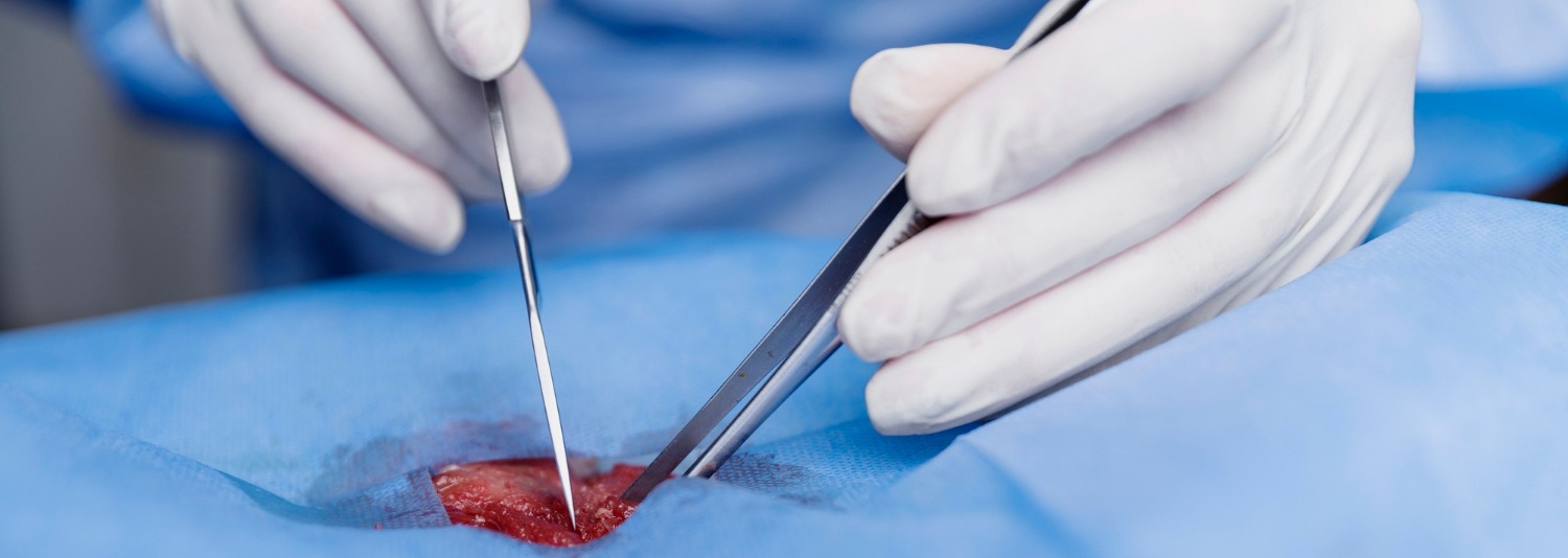 Cesarean Section  Banner