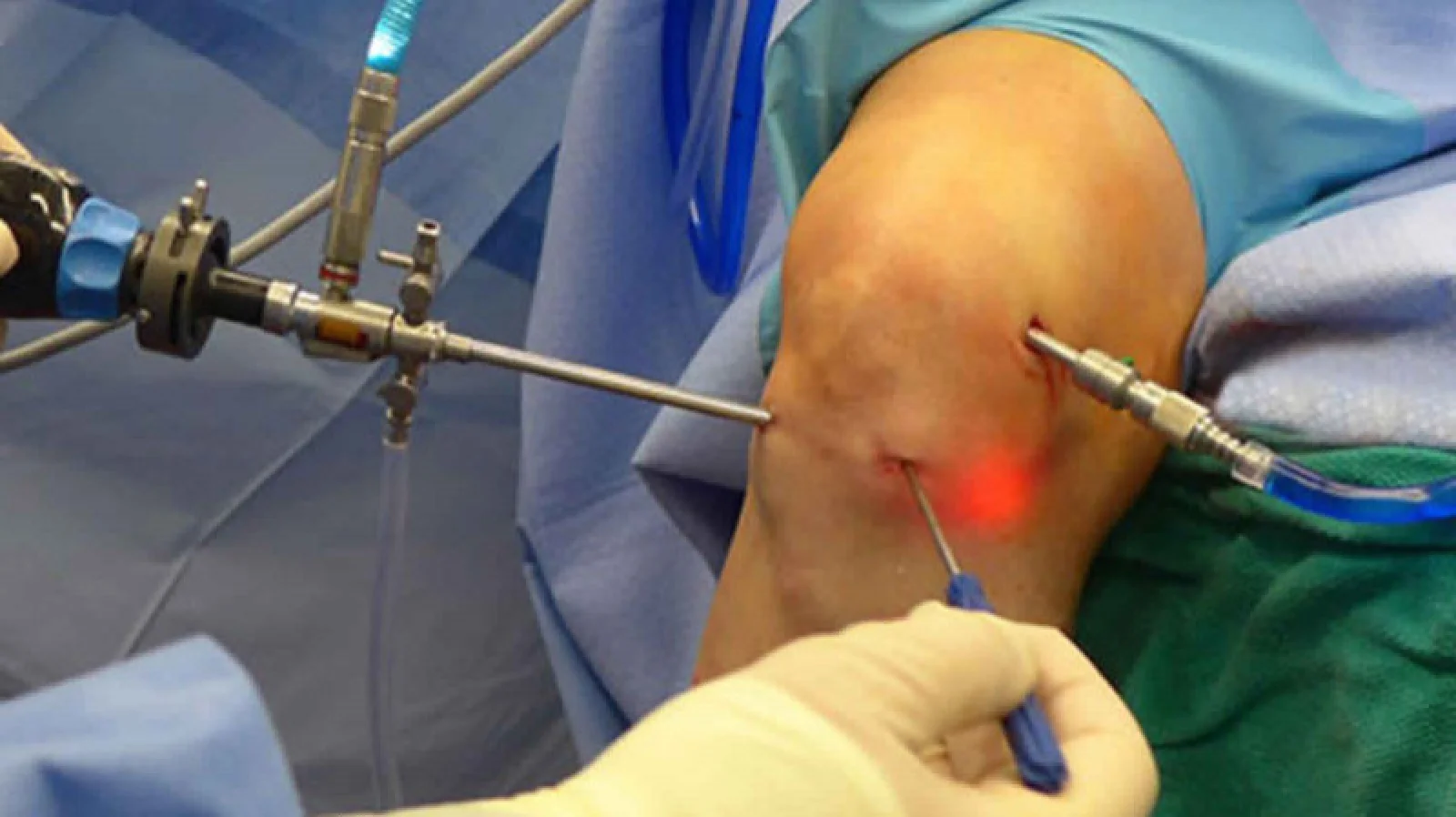 Joint Arthroscopy Banner