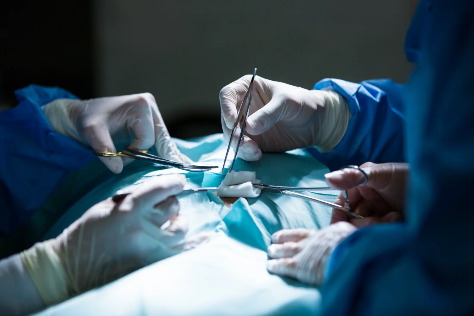 Pyeloplasty Banner