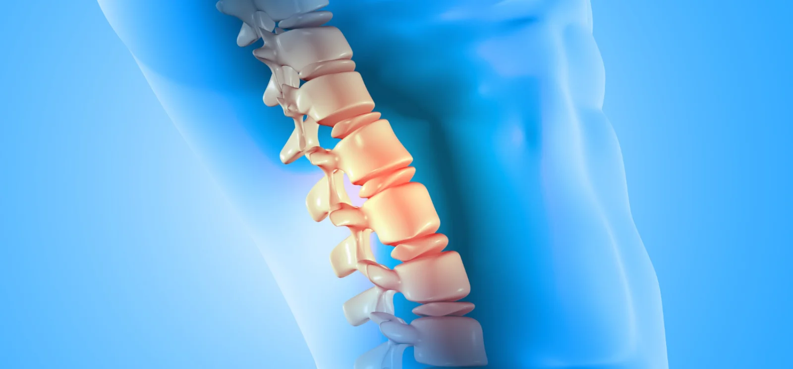 Discectomy (Cervical / Lumbar) Banner