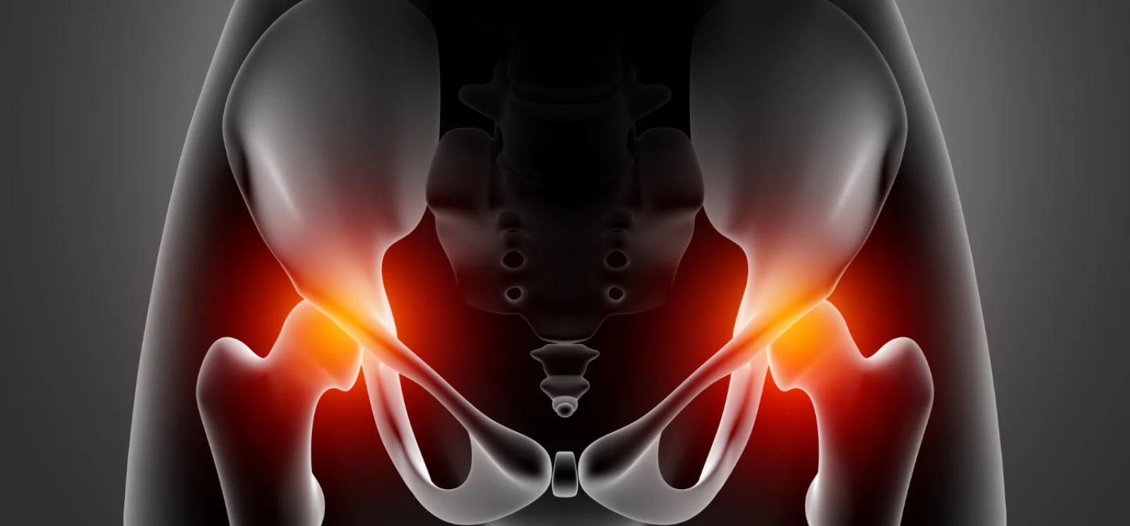 Hip Arthroscopy Banner