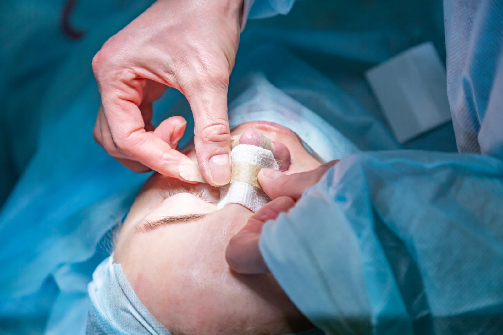 Hypospadias Repair Surgery Banner