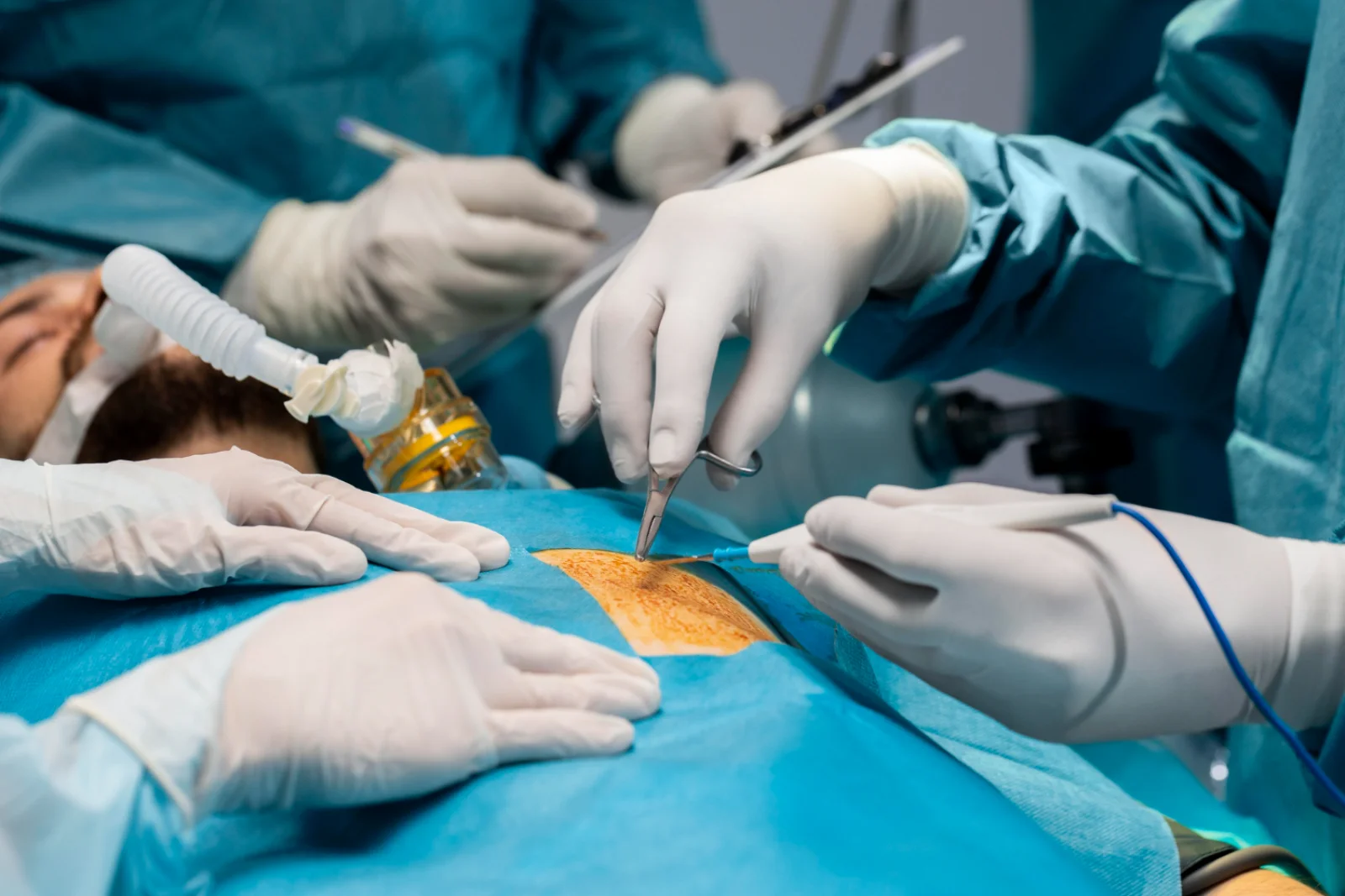 Oncologic Resections (Colon, Breast, Thyroid, Liver, Pancreas) Banner