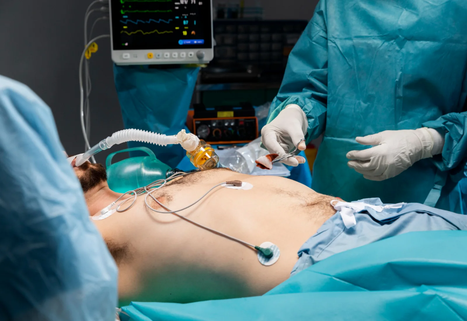 PCNL (Percutaneous Nephrolithotomy) Banner