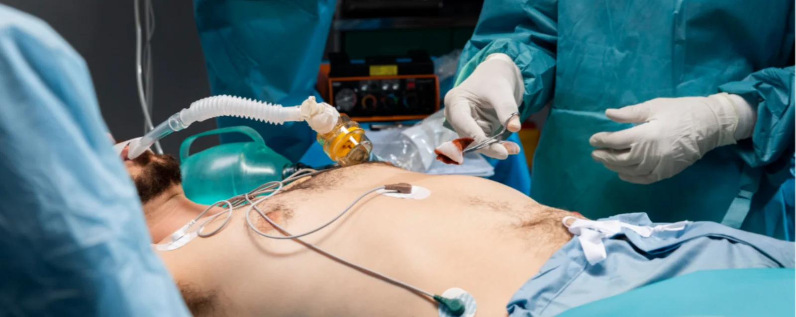 Cholecystectomy  Banner